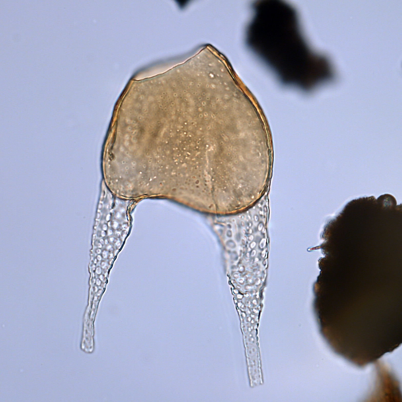 Odontochitina porifera, U1581-28R-6W, 106-110, sl. 1, U24-1, foto-c.jpg